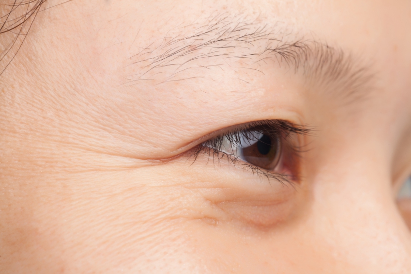 eye wrinkles iStock_000028715344_Small
